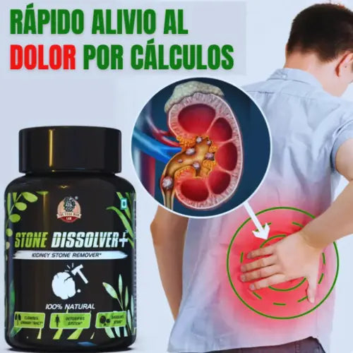SUPLEMENTO RENAL PARA ELIMINAR CÁLCULOS | 100 % NATURAL - 🚨GRAN PROMOCIÓN 🚨